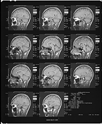 MRI image #1